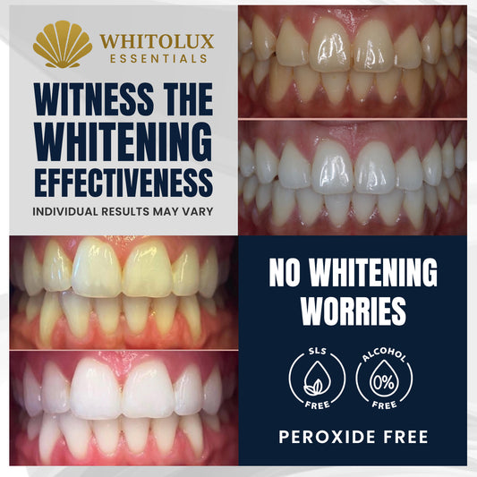 WHITOLUX by Oralux Essentials